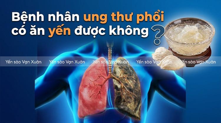 benh-nhan-ung-thu-phoi-co-an-yen-duoc-khong-01
